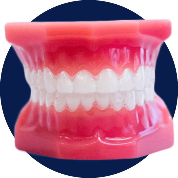Clear Aligners at Kwong Orthodontics